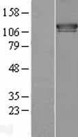 ESYT1 Protein (Over-Expression Lysate Myc-DDK (Flag))