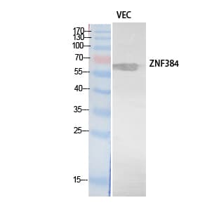 ZNF384 Antibody