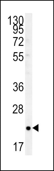 RHOQ / TC10 Antibody (aa48-76)