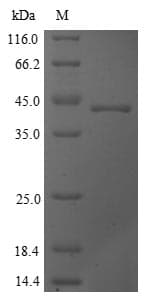 Saccharomyces cerevisiae CYS3 Protein (Recombinant 6His, N-terminus)
