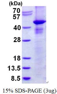 Human RASSF1 / RASSF1A Protein (Recombinant His)