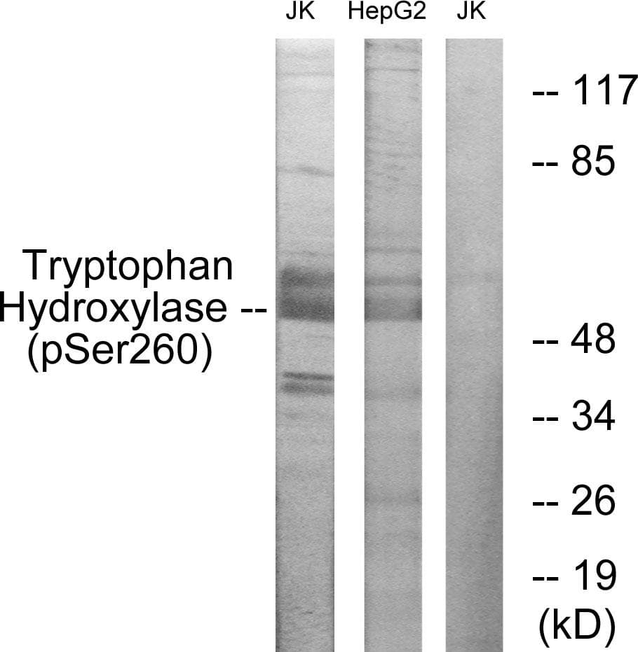 TPH1 / Tryptophan Hydroxylase Antibody (phospho-Ser260)