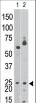 Polyclonal Rabbit anti-Human NIP3 / BNIP3 Antibody (aa152-187, IHC, IF, WB)