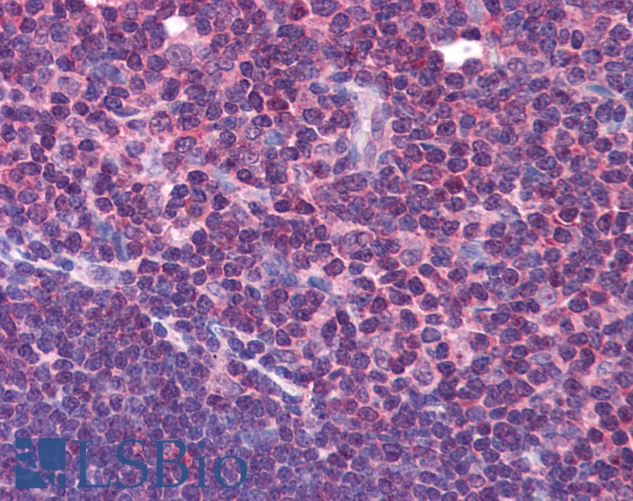 IHC-plus™ HVCN1 / HV1 Antibody