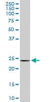 DCUN1D1 / SCCRO Antibody (clone 4B5)