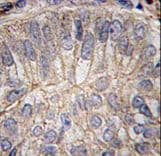 CDH3 / P-Cadherin Antibody (aa660-688)