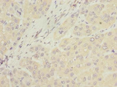 NUBPL Antibody