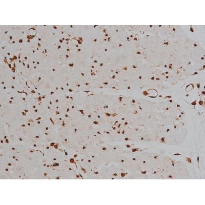 MAPT / Tau Antibody (phospho-Thr231)