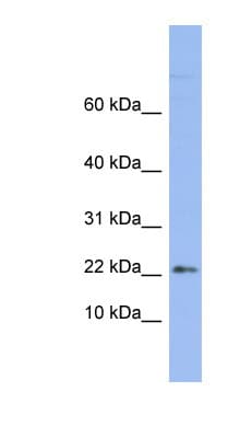 RPS24 / Ribosomal Protein S24 Antibody (aa71-120)