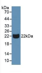 PGLYRP1 / PGRP Antibody (aa22-196)