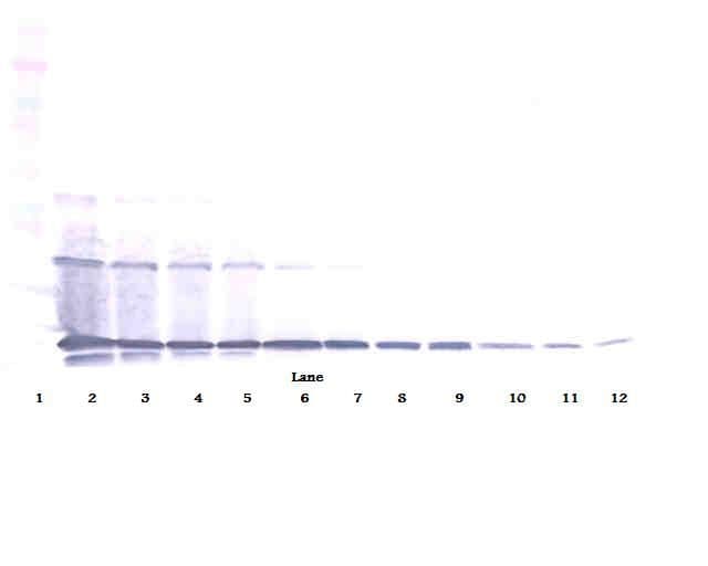 IHC-plus™ TNFSF11 / RANKL / TRANCE Antibody