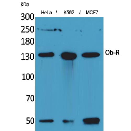 LEPR / Leptin Receptor Antibody (791-840 aa, Internal)