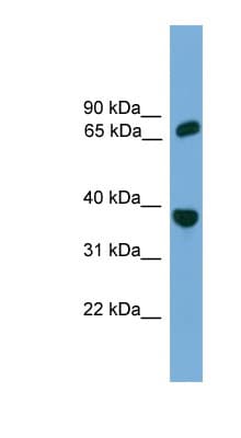 POT1 Antibody (aa251-300)