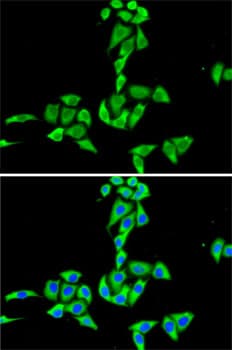 CES2 / Esterase Antibody