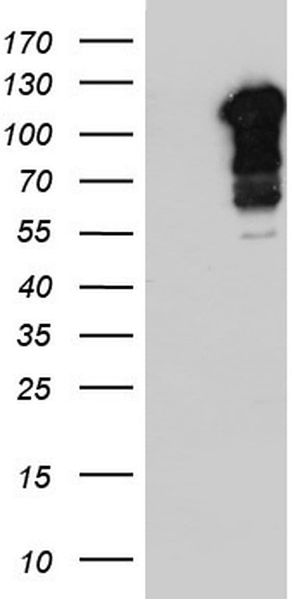 BFSP1 / Filensin Antibody (aa405-665, clone OTI1F1)