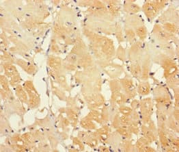 IFT22 / RABL5 Antibody (aa1-185)