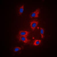 F2R / Thrombin Receptor / PAR1 Antibody (N-Terminus)