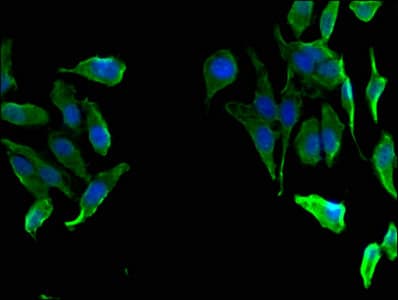 Polyclonal Rabbit anti-Human FAH Antibody