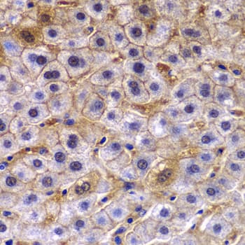 Polyclonal Rabbit anti-Human TCTN3 Antibody (IHC, WB)