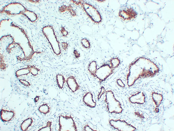 PR / Progesterone Receptor Antibody (clone ABT-PR)