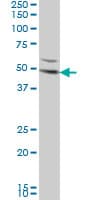 DKK1 Antibody (clone 2B12)