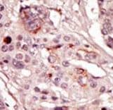 SRMS Antibody (aa19-48)