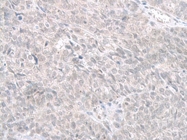 STAU2 Antibody