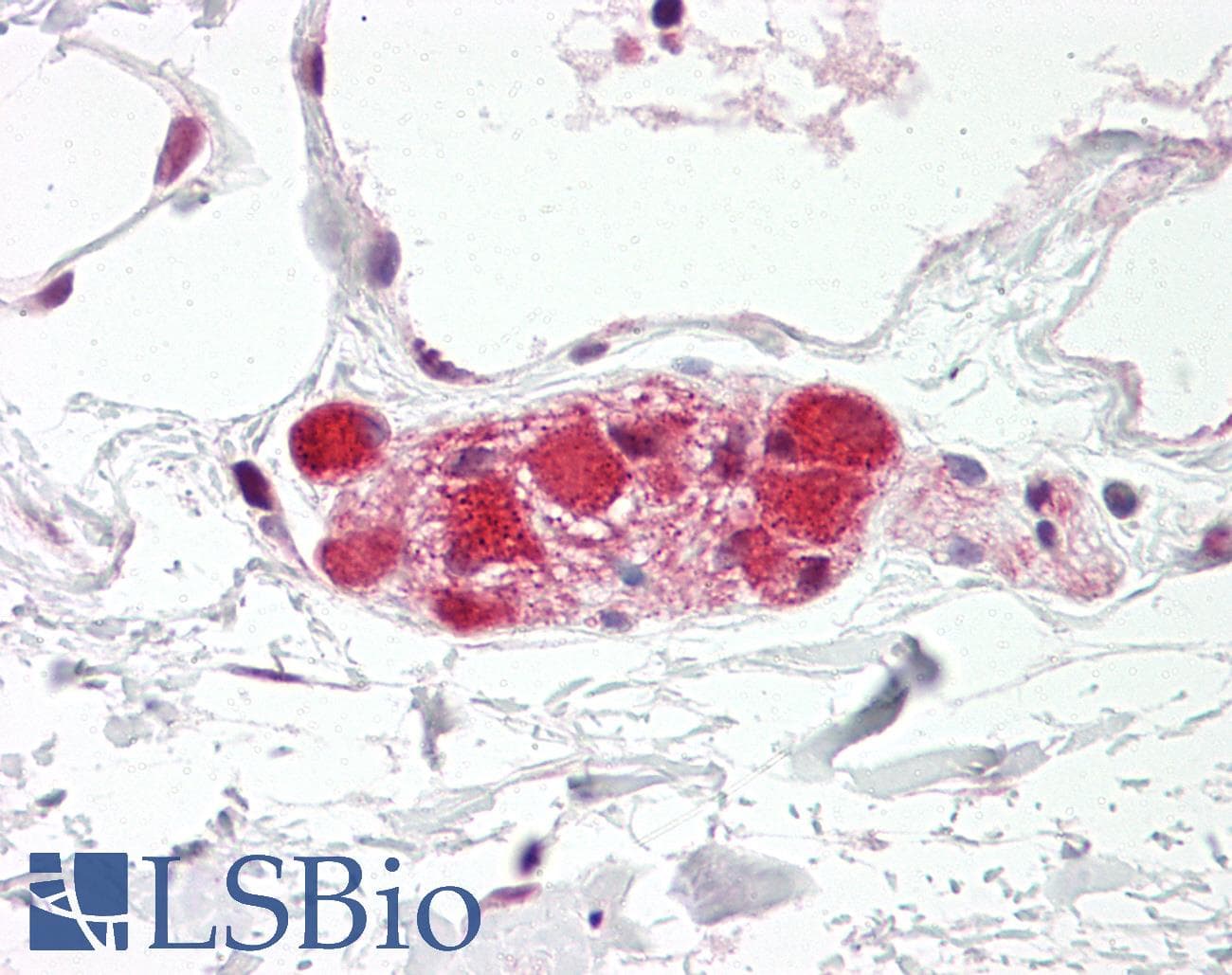 DLG4 / PSD95 Antibody (aa683-732, Biotin)