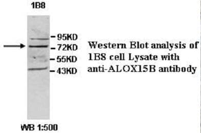 Polyclonal Rabbit anti-Human ALOX15B / 15-LOX-2 Antibody (aa21-262, IHC, WB)
