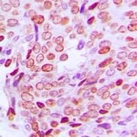 PFDN1 Antibody (N-Terminus)