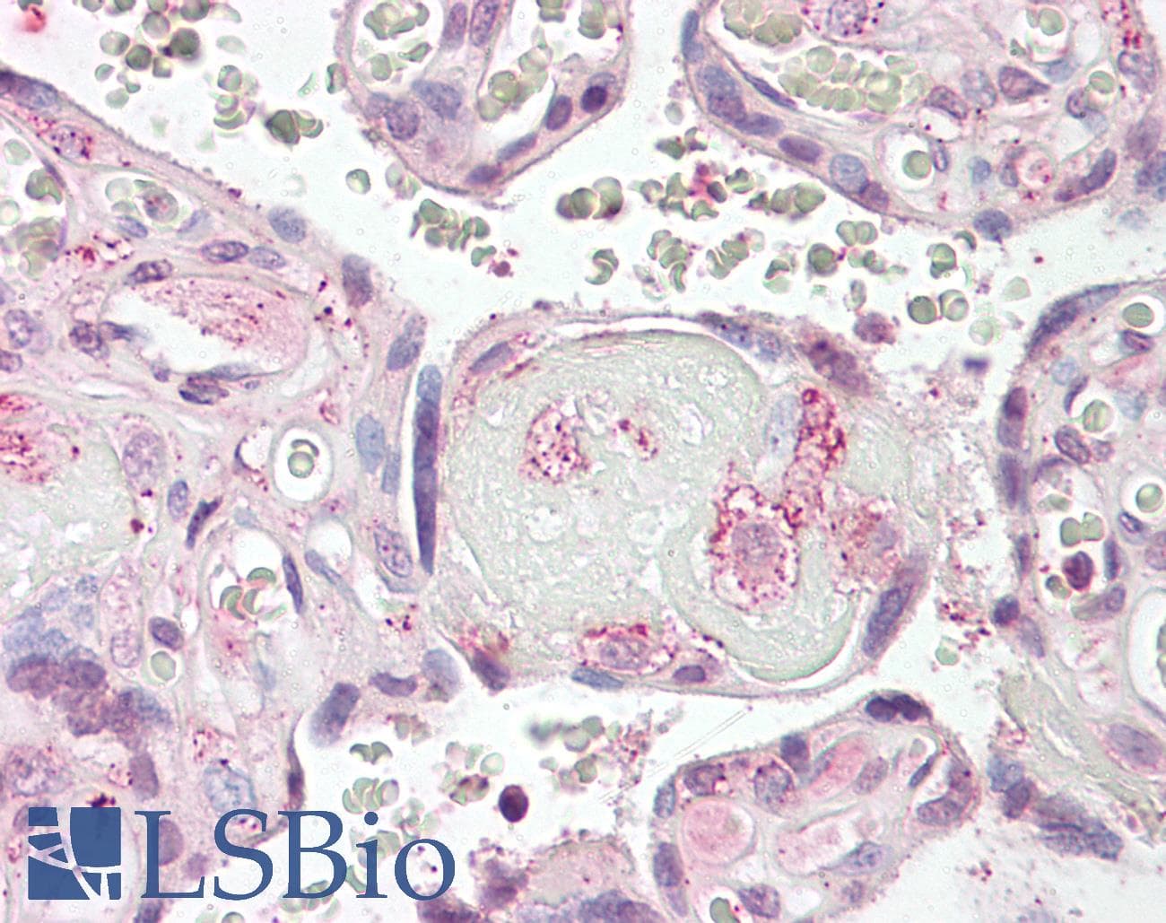 IHC-plus™ LYN Antibody (aa39-58)
