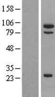 MSH5 Protein (Over-Expression Lysate Myc-DDK (Flag))