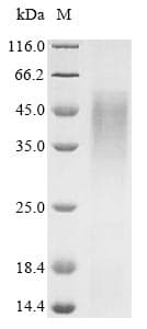 Mouse NIP3 / BNIP3 Protein (Recombinant 10His, N-terminus)