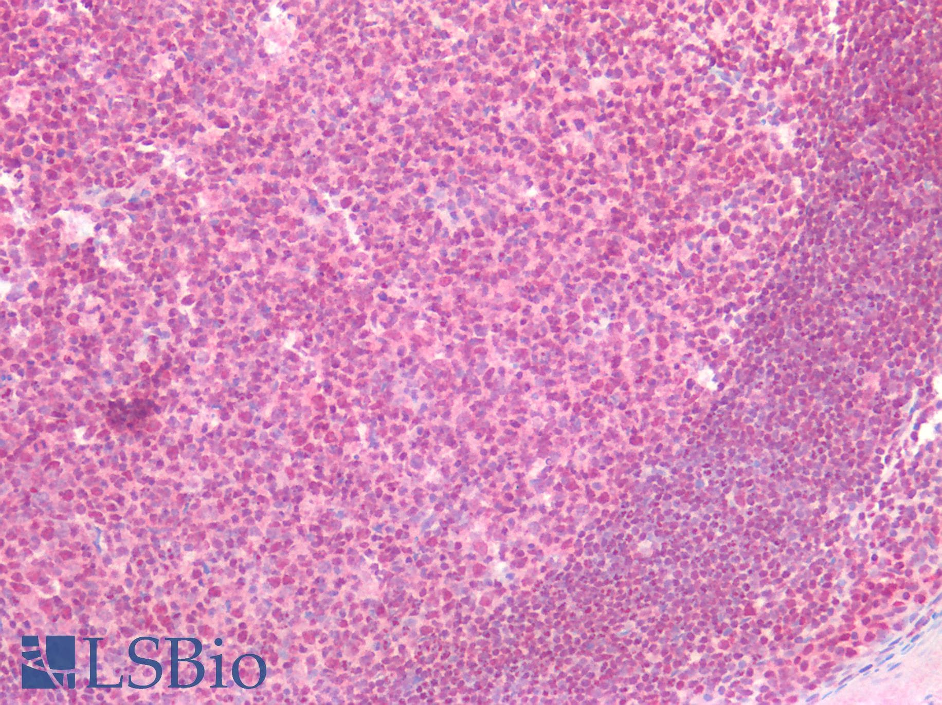 PathPlus™ ERG Antibody (clone 8A9)