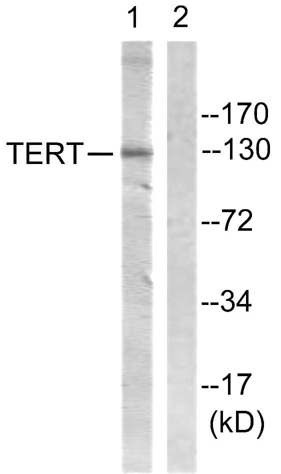 TERT / Telomerase Antibody (p824)