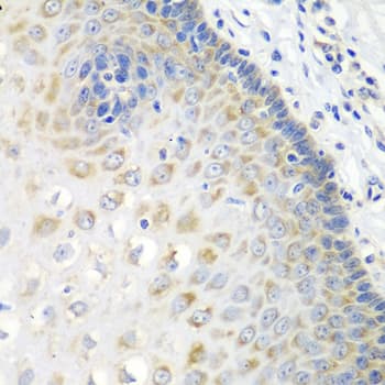 STXBP4 Antibody