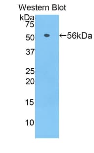 CDH1 / E Cadherin Antibody (aa375-631)