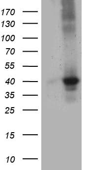 UP2 / UPP2 Antibody (clone OTI10A3)