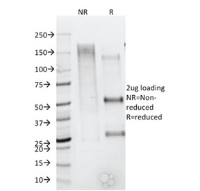 CD79B / CD79 Beta Antibody (clone IGB/1844, Azide-free, BSA-free)