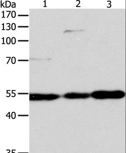 GSR / Glutathione Reductase Antibody