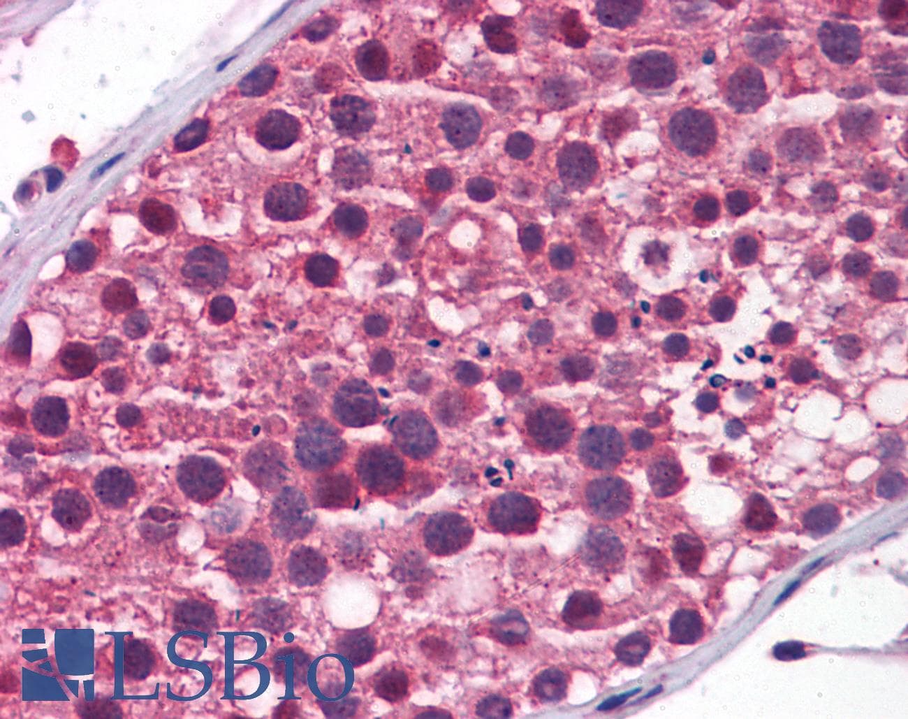 Polyclonal Rabbit anti-Human TDRD9 / HIG-1 Antibody (aa1071-1120, IHC, WB)