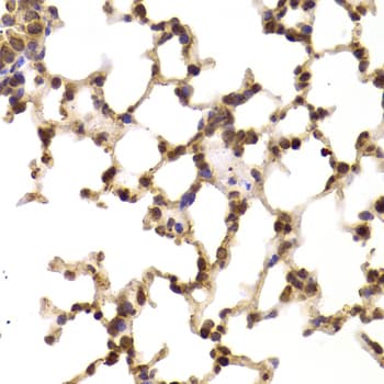 EIF5 Antibody