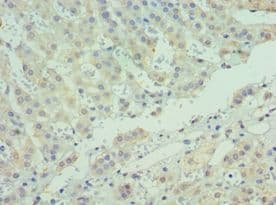 Polyclonal Rabbit anti-Human STOM / Stomatin Antibody (aa55-288, IHC, WB)