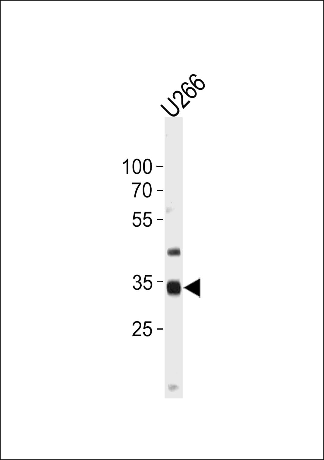 NKX3-2 / BAPX1 Antibody (aa208-235)