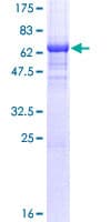 Human NDRG2 Protein (Recombinant GST)