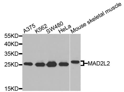 Polyclonal Rabbit anti-Human MAD2B / REV7 Antibody (IHC, WB)