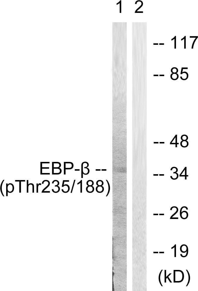 Polyclonal Rabbit anti-Human C/EBP Beta / CEBPB Antibody (phospho-Thr235/188, IHC, IF, WB)