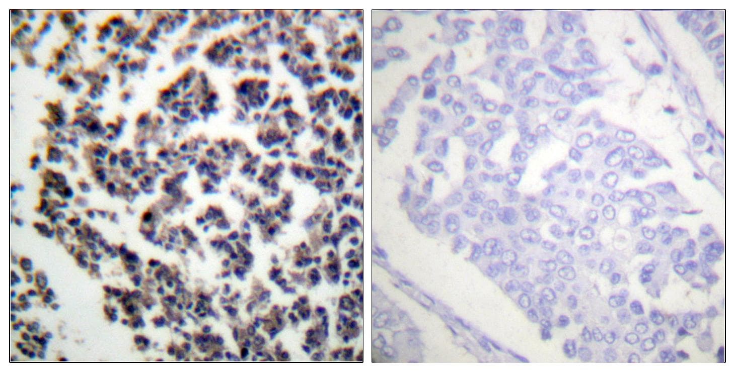 BLNK Antibody (phospho-Tyr96)