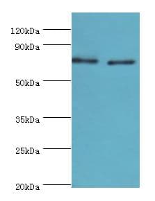 TGM2 / Transglutaminase 2 Antibody (aa438-687)