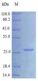 Human VEGFA / VEGF Protein (Recombinant)